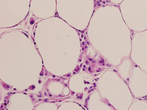 0218 10 faktů o tělesné hmotnosti