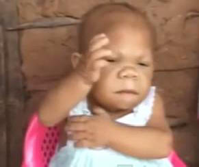 32letá žena má tělo jednoletého dítěte