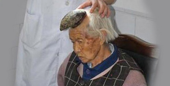 A rohy na hlavě rostou u žen