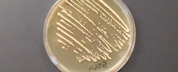 Američané chovali kvasinky, které přeměňují cukr v opium