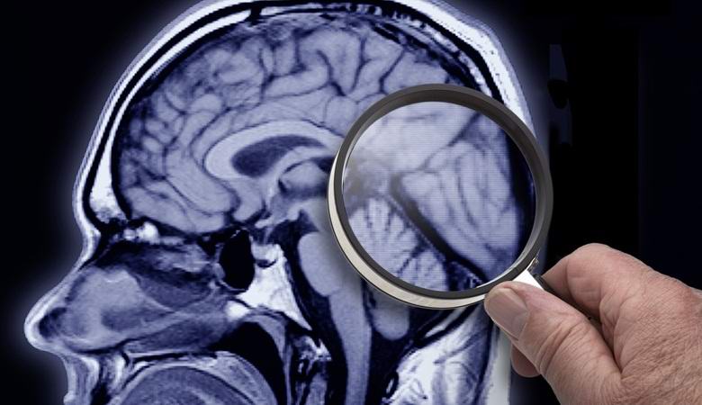 Američané brzy začnou vychovávat mrtvé.