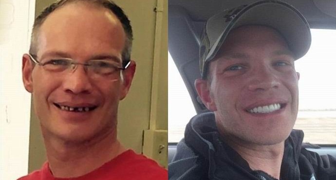 Američan opustil číšníka dvacet pět tisíc za zubní ošetření.