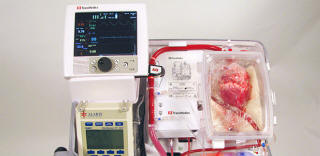 Australští lékaři se naučili transplantovat lidi mrtvými srdci