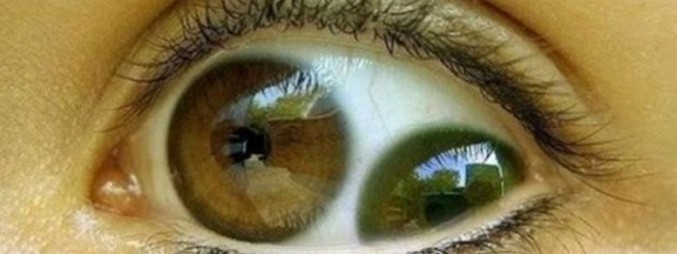 Existuje dvojitý žák?