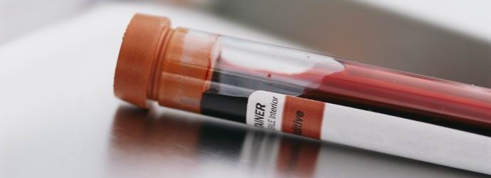 Člověk má třicet pět známých krevních typů.