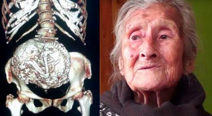 Chilean měla dítě šest desetiletí.