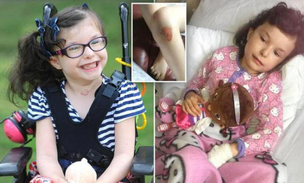 Dívka, která necítí bolest