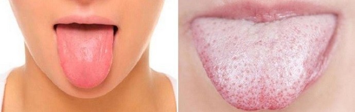 Chceš znát své zdraví - zvedni zrcadlo