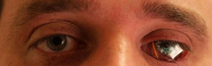 A přijít s více a dokonalejšími ... berlemi