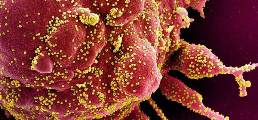 Studie ukazuje, že COVID-19 by mohl přinutit imunitní systémy k útoku na sebe 