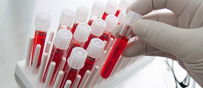 Kanaďané mohou učinit všechny typy krve kompatibilními.