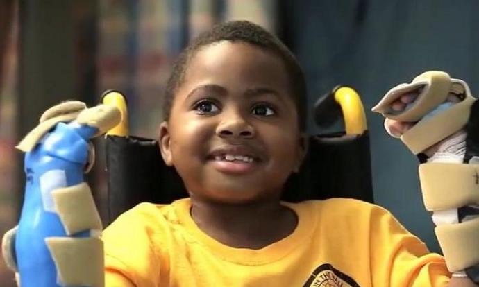 Chlapec znovu získal ruce