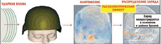 Náboj je soustředěn hlavně v oblasti obočí.