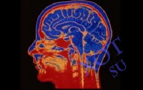 Mozkové implantáty pomohou člověku pracovat efektivněji.