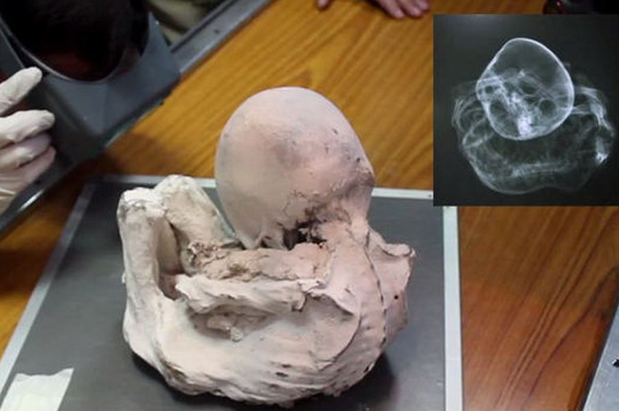 Mumie Nazca: co ukázala pátá studie