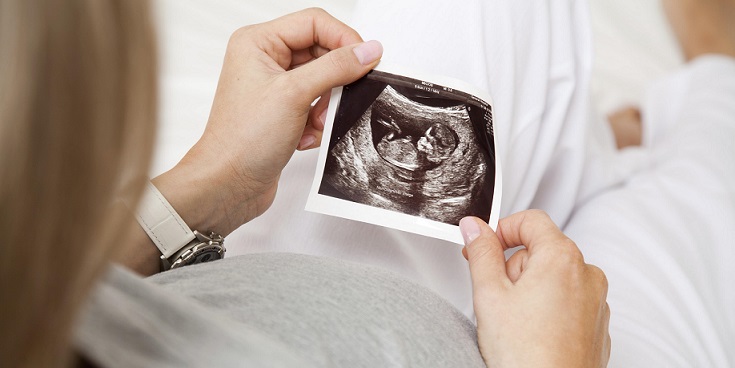 Při intrauterinním ultrazvukovém vyšetření byl nalezen zesnulý příbuzný
