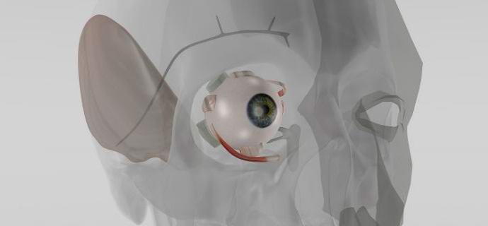 Němci vymysleli implantát k regulaci nitroočního tlaku.