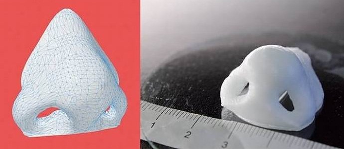 Neobvyklá tiskárna vytváří protézy z lidské tkáně