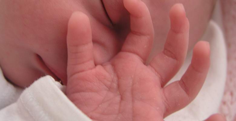 O thajské dívce narozené s maskotem v ruce