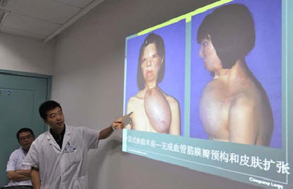 V Číně byla provedena další šokující plastická chirurgie.