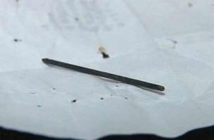 Akupunkturní jehla prošla tělem čtyřicetiletého muže