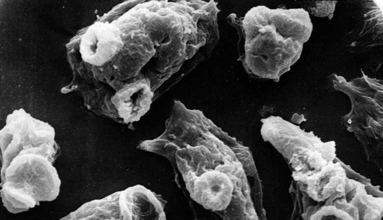 Mozek jíst amébu přinesl hurikán IRMA do USA