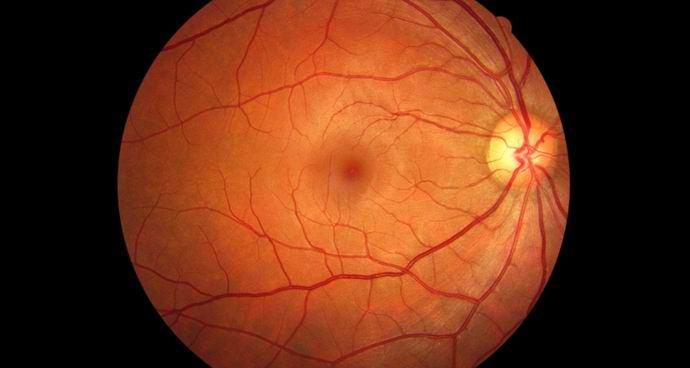 Let na Mars může astronautům připravit o zrak.