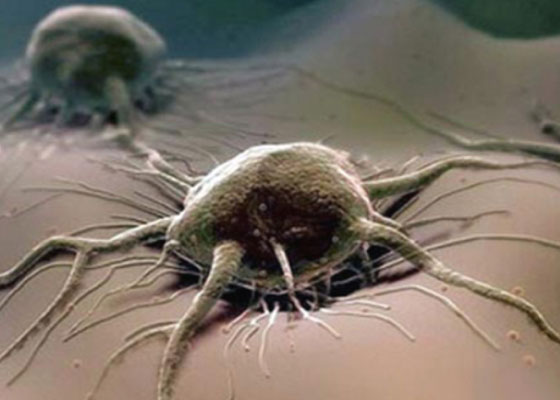 Je rakovina příčinou smrtelné nehody?