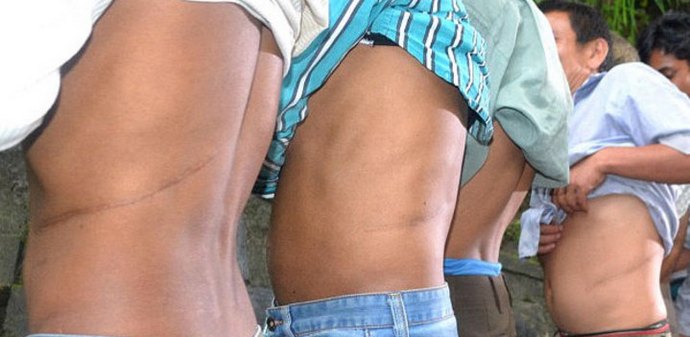 Prodej ledvinu a koup si dům