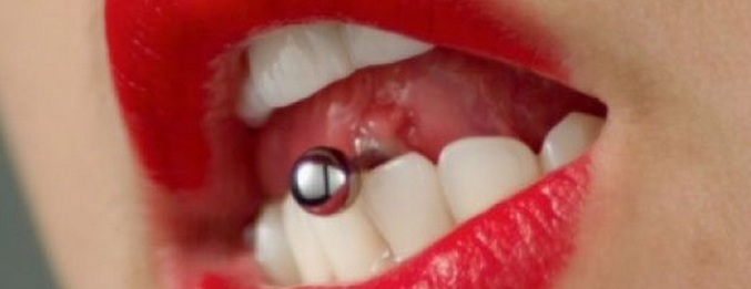 Prorazil jazyk - ztratil přední zuby