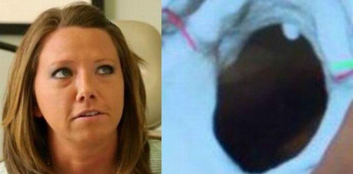 Vzácná nemoc způsobuje, že Američan slyší její práci s tělem.