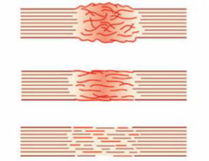 S pomocí biologické rukojeti může být každé poškození tkáně rychle vyléčeno.