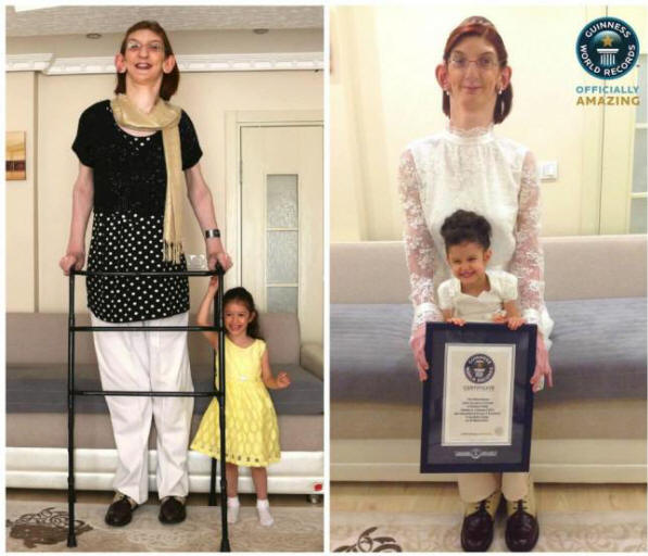 Nejvyšší dívka na světě