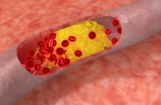 Schopnosti získané v důsledku vzácných genetických mutací u lidí