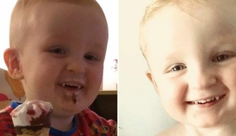 Anglický chlapec najednou dostal tesáky