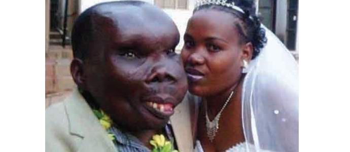 Nejškaredější muž v Ugandě má osmé dítě.