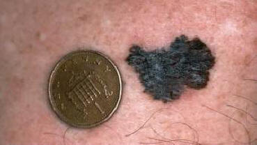 Vědci přišli s tím, jak