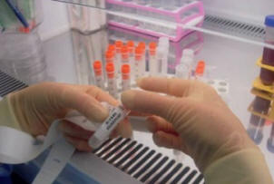 Vědci dokázali přeměnit obyčejné buňky na kmenové buňky