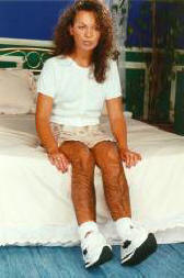 Vynalezená chlupatá punčocháče s funkcí proti znásilnění