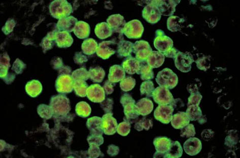 V Louisianě je voda kontaminována amébami, které jedí mozek.