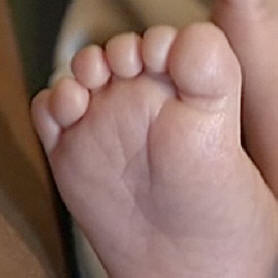 V oblasti Fukušima roste počet dětí se šesti prsty.