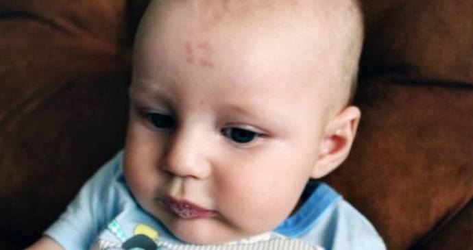 V Jižní Africe je chlapec označen mateřským znaménkem - číslem dvanáct.