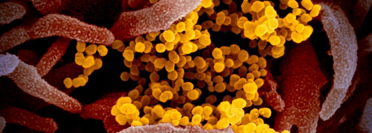 Takto vypadá virus COVID-19 pod mikroskopem 