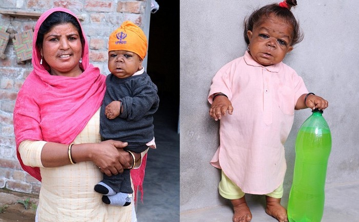 Dospělý Ind s tělem šestiměsíčního dítěte