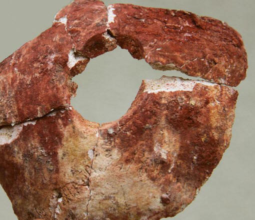 Proč před šesti tisíci lety chirurgové dělali trepanaci?